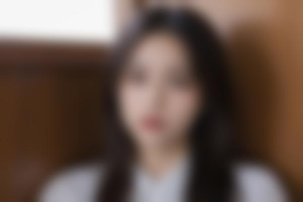 苏晖展医生微整形怎么样？