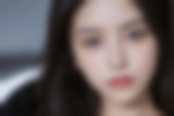 廉惜然下面部轮廓修复为什么值得选？