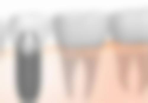 杭州美奥口腔医院：连锁品牌的信赖之选