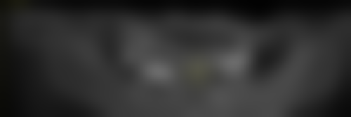 2026年杭州市韩国美格真MegaGen医院排名揭晓，附各院种植价格及特色 