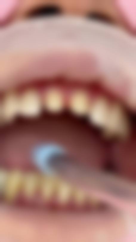 贵阳南明博皓口腔门诊部医院顾客的口碑评价