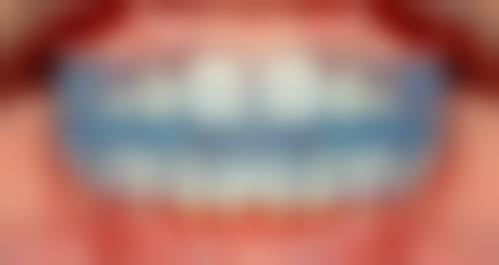 杭州美奥口腔医院:国内外化的口腔服务