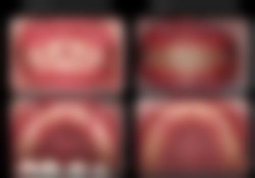 杭州艾维口腔医院:高品质口腔服务