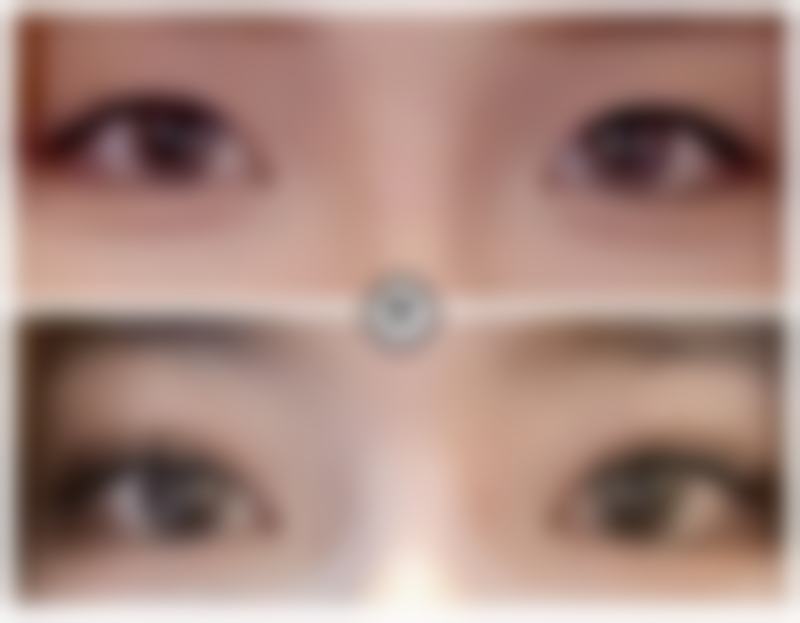 长沙亚韩医学美容医院艾竹林医生的收费价格表