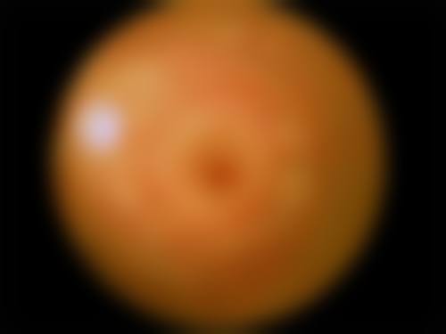 陇南眼科医院医院来院路线