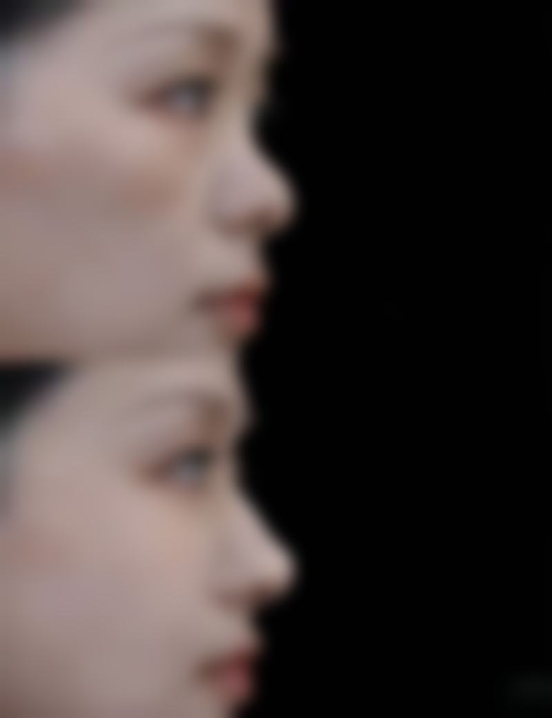 韩国世民整形外科医院顾客的口碑评价