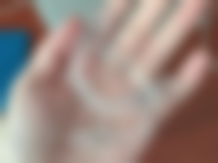 （T）宁都县管江口腔门诊部医院预约方式