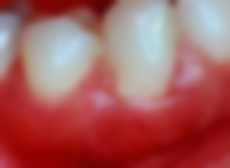 广州德伦口腔(京溪院)医院来院路线