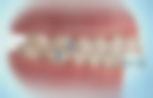 东莞牙优等生及牙状元口腔苏海晶医生的收费价格表