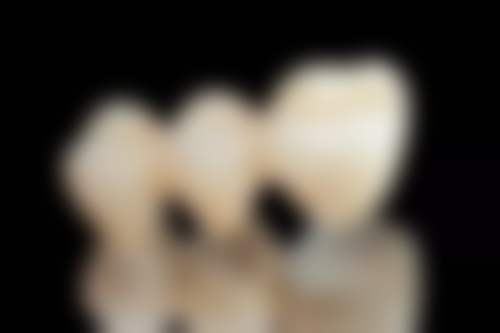 承德可米口腔门诊部宋国峰医生擅长项目