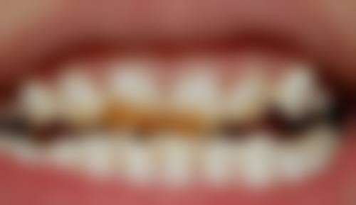 绵阳恒齿口腔门诊部医院开展项目