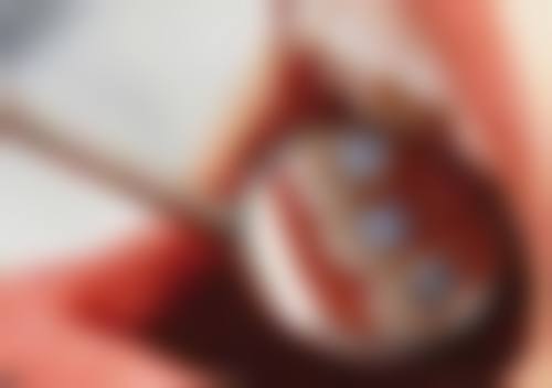 南方医 科 大学南方医院妇产科刘楠（副主医师）医生口碑评价