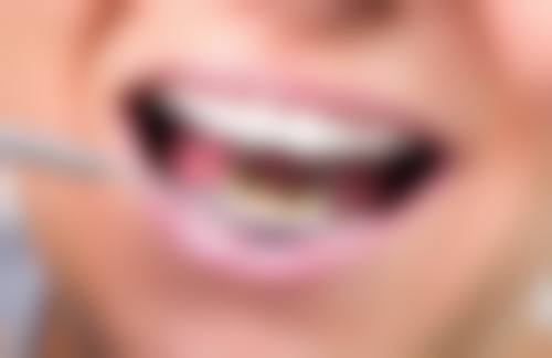 广东东莞高丽口腔医院来院路线