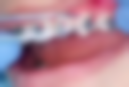 广东东莞高丽口腔医院地址