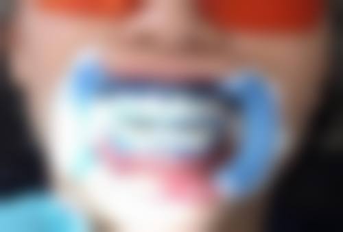 广东省中山市人民医院黄彦医生技术特色