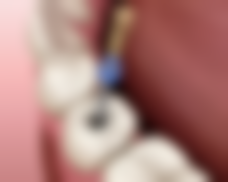 广东韶关牙博仕口腔医院预约方式