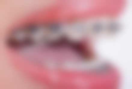 上高县人民医院郑荣医生简介