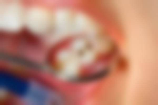 银川市金凤区优诺齿科口腔诊所宁安宜居店