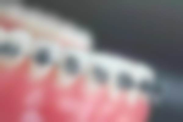 银川市金凤区优诺齿科口腔诊所宁安宜居店医院特色项目