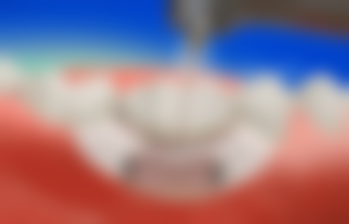 兰山舒格兰松果口腔门诊部医院预约方式