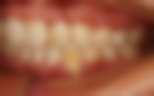 广东佛山林琳口腔医院预约方式