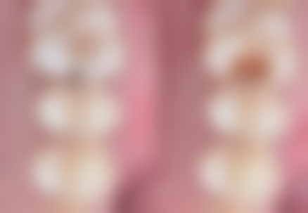 山东菏泽巨野冬梅口腔诊所医院开展项目