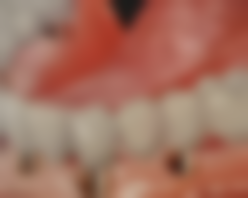 海口牙联邦口腔门诊部黄宏恩医生技术特色