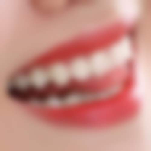 海口牙联邦口腔门诊部黄宏恩医生怎么预约挂号