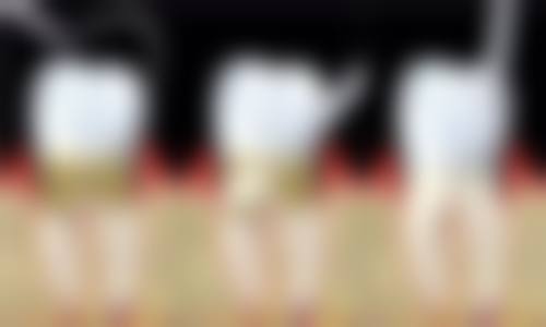 云南大理祥云县鼎丰口腔医院开展项目