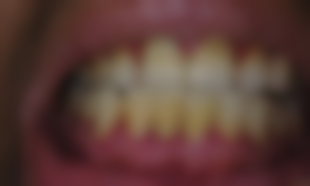 韩国奥斯卡整形外科医院开展项目