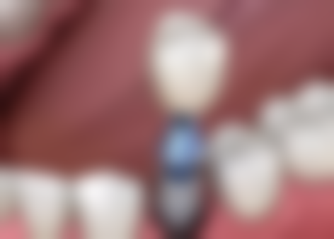 中医何波医生（何氏百草堂第四代传承人）的收费价格表