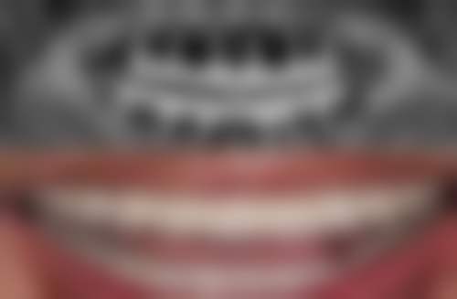 深圳雅美天使口腔诊所医院地址