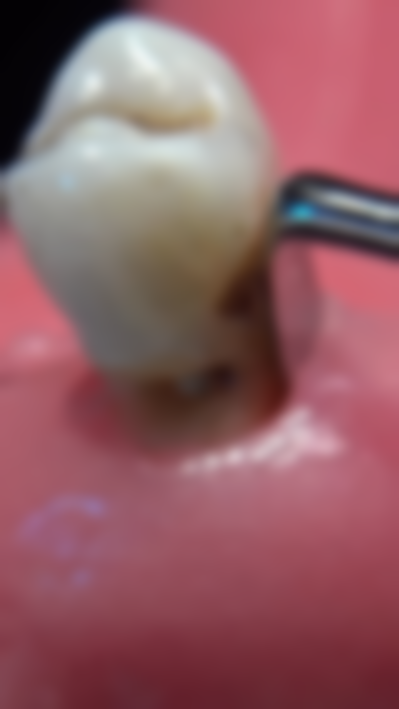 金华永康光大医疗美容医院刘瑞医生怎么预约挂号