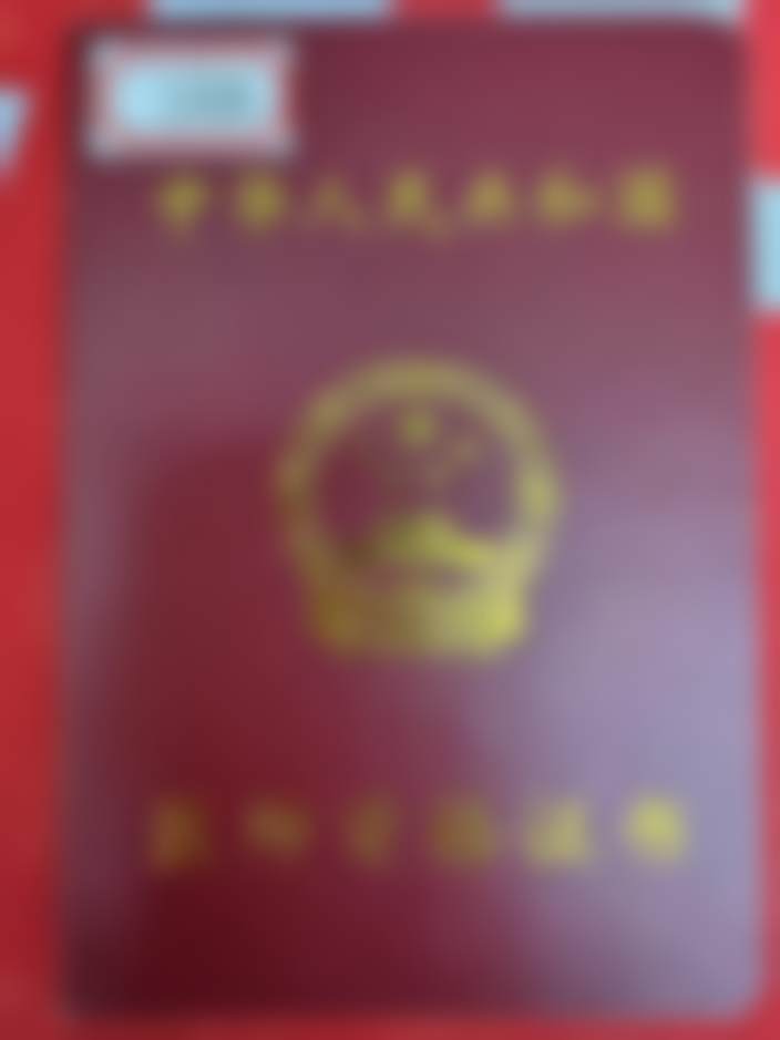 普通树脂前牙隐形义齿的特色