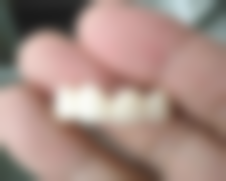 广东揭阳磐东亮白口腔医院项目价格