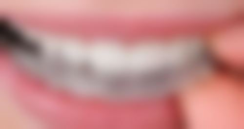 西安泰康拜博口腔医院医院预约方式