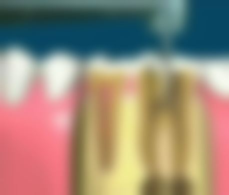 连云港东海微笑口腔门诊部医院项目价格