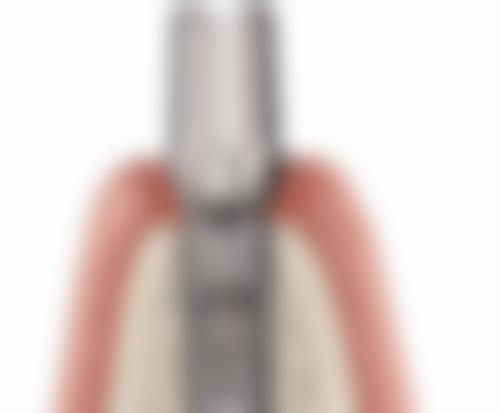 福州登特口腔祝磊医生口碑评价