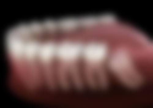 悦尔口腔门诊部及东莞东城特美口腔门诊部张遂才医生口碑评价