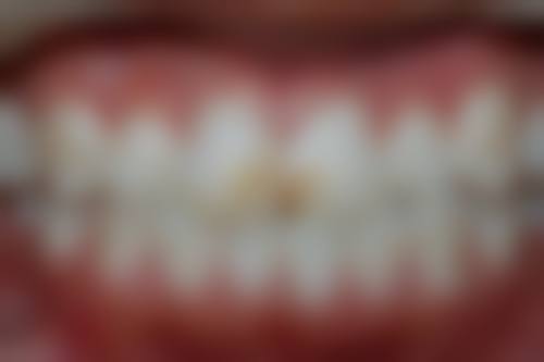 安徽省儿童医院刘洪军 医生技术特色