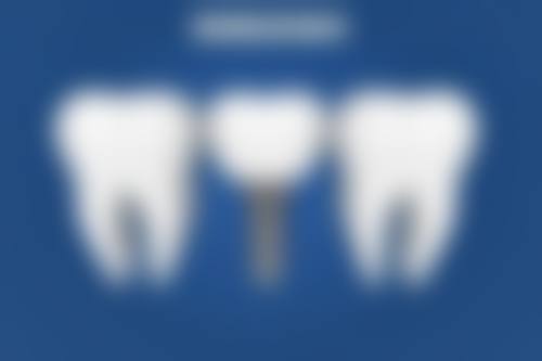 深圳一欣口腔门诊部邓航医生简介