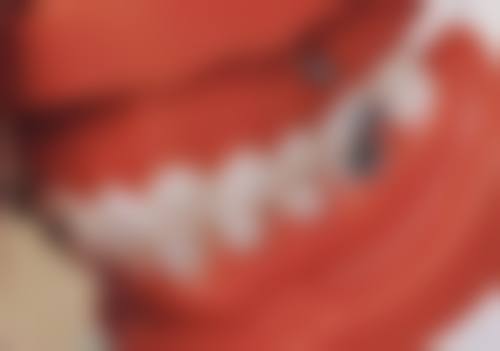 成都圣贝牙科朱海医生口碑评价