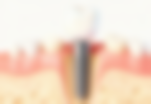 成都圣贝牙科朱海医生怎么预约挂号