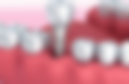 深圳元亨民健口腔诊所医院特色项目