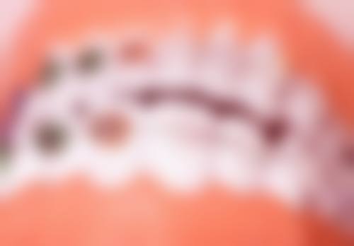 东阳市狐狸口腔门诊部(数字化矫正·种植中 心)医院顾客的口碑评价