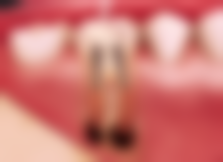 开福欣颖口腔门诊部医院开展项目