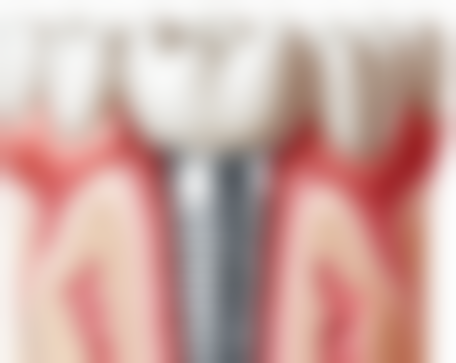 南京维尔建口腔门诊部(大厂分院)医院预约方式