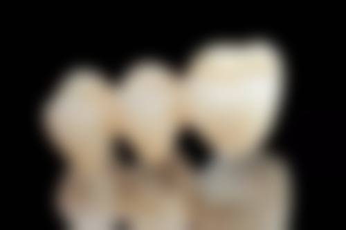 杭州禾木口腔门诊部贝泽欣医生的收费价格表