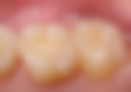 乌鲁木齐精良口腔医院项目价格