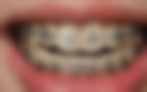 哈尔滨大象口腔(世茂店)医院特色项目